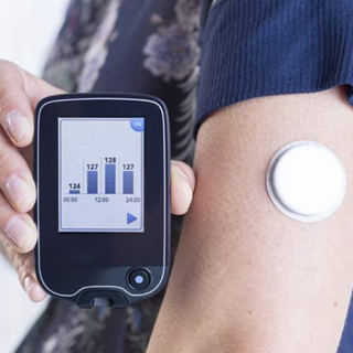 持续血糖监测